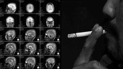 Using nicotine while the brain 